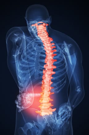 Back Pain: How Chiropractors Can Help | Peak Chiropractic
